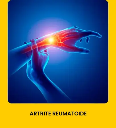artrite-reumatoide-combodor