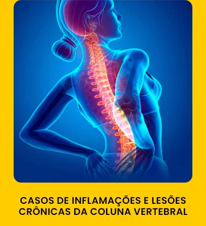 casos-inflamacoes-lesoes-coluna-vertebral-combodor