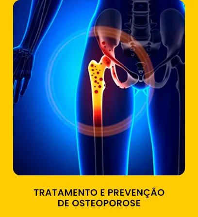 tratamento-prevencao-de-osteoporose-combodor